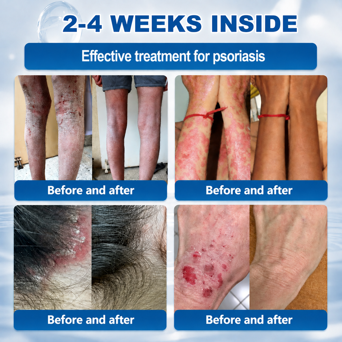𝐇𝐞𝐚𝐥𝐫𝐢𝐳𝐞® 𝟕-𝐃𝐚𝐲 𝐒𝐤𝐢𝐧 𝐓𝐚𝐠 & 𝐒𝐩𝐨𝐭 𝐄𝐫𝐚𝐬𝐞𝐫 𝐂𝐫𝐞𝐚𝐦 (𝐙𝐞𝐫𝐨 𝐏𝐚𝐢𝐧, 𝐙𝐞𝐫𝐨 𝐒𝐜𝐚𝐫𝐬 𝐅𝐨𝐫𝐦𝐮𝐥𝐚)💎💎