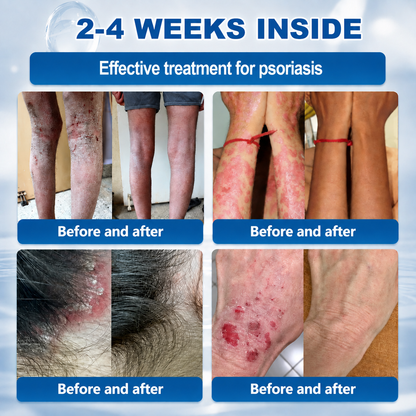 𝐇𝐞𝐚𝐥𝐫𝐢𝐳𝐞® 𝟕-𝐃𝐚𝐲 𝐒𝐤𝐢𝐧 𝐓𝐚𝐠 & 𝐒𝐩𝐨𝐭 𝐄𝐫𝐚𝐬𝐞𝐫 𝐂𝐫𝐞𝐚𝐦 (𝐙𝐞𝐫𝐨 𝐏𝐚𝐢𝐧, 𝐙𝐞𝐫𝐨 𝐒𝐜𝐚𝐫𝐬 𝐅𝐨𝐫𝐦𝐮𝐥𝐚)💎💎