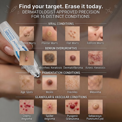 𝗛𝗜𝗦𝗞𝗜𝗡®👩‍⚕️ 𝟕-𝐃𝒂𝘆 𝐒𝗸𝐢𝐧 𝐓𝒂𝗴 & 𝐒𝐩𝙤𝐭 𝐄𝐫𝒂𝐬𝙚𝐫 Painless & Scar-Free Advanced Imperfection Removal Rollerball Pen🎉🎉🎉