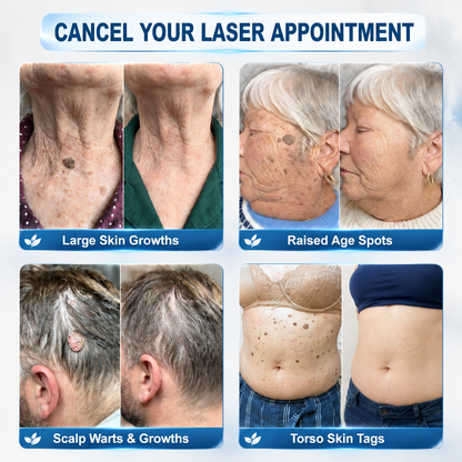 𝐇𝐞𝐚𝐥𝐫𝐢𝐳𝐞® 𝟕-𝐃𝐚𝐲 𝐒𝐤𝐢𝐧 𝐓𝐚𝐠 & 𝐒𝐩𝐨𝐭 𝐄𝐫𝐚𝐬𝐞𝐫 𝐂𝐫𝐞𝐚𝐦 (𝐙𝐞𝐫𝐨 𝐏𝐚𝐢𝐧, 𝐙𝐞𝐫𝐨 𝐒𝐜𝐚𝐫𝐬 𝐅𝐨𝐫𝐦𝐮𝐥𝐚)💎💎