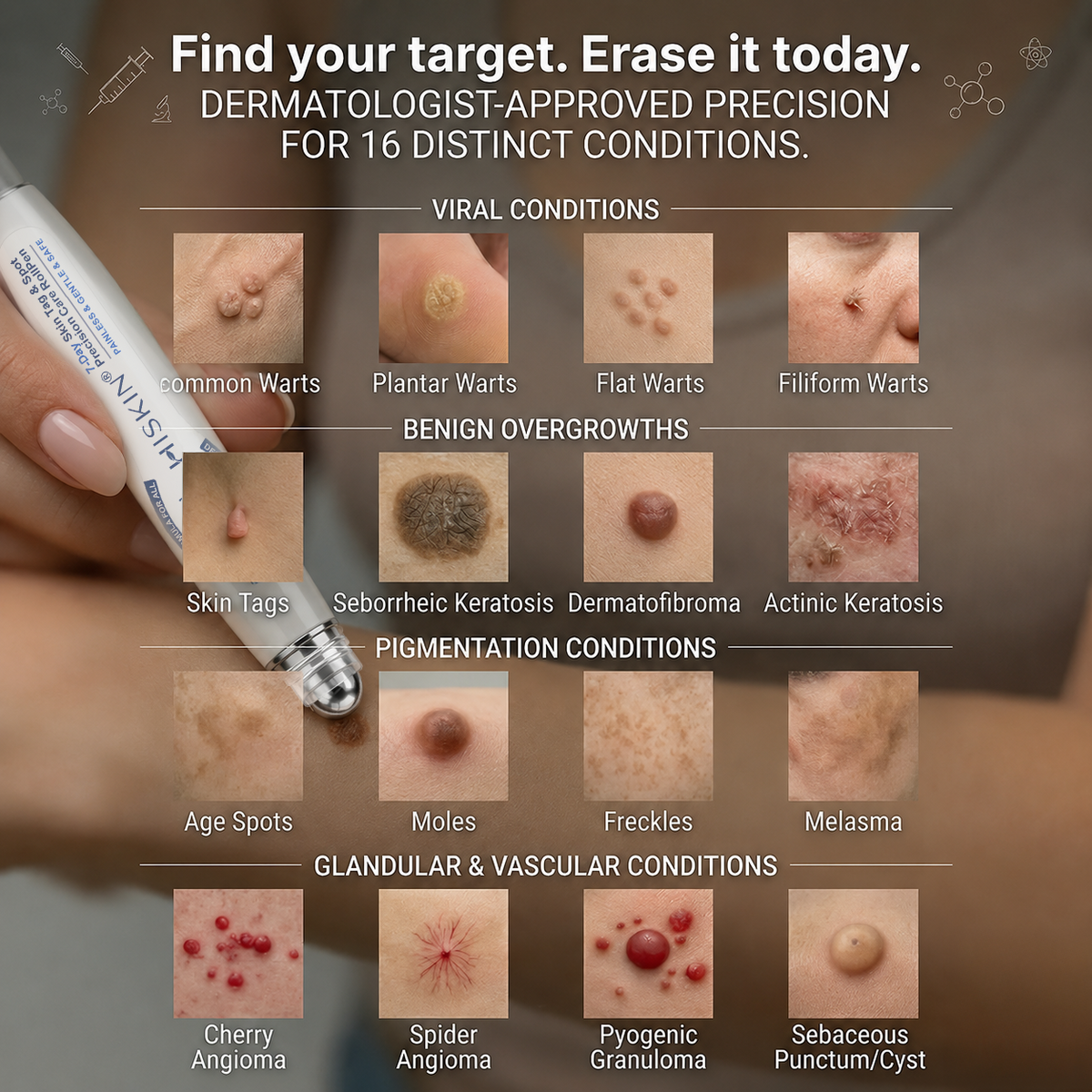 𝐇𝐈𝐒𝐊𝐈𝐍®👩‍⚕️ 𝟕-𝐃𝒂𝘆 𝐒𝗸𝐢𝐧 𝐓𝒂𝗴 & 𝐒𝐩𝙤𝐭 𝐄𝐫𝒂𝐬𝙚𝐫 Painless & Scar-Free Advanced Imperfection Removal Rollerball Pen🎀