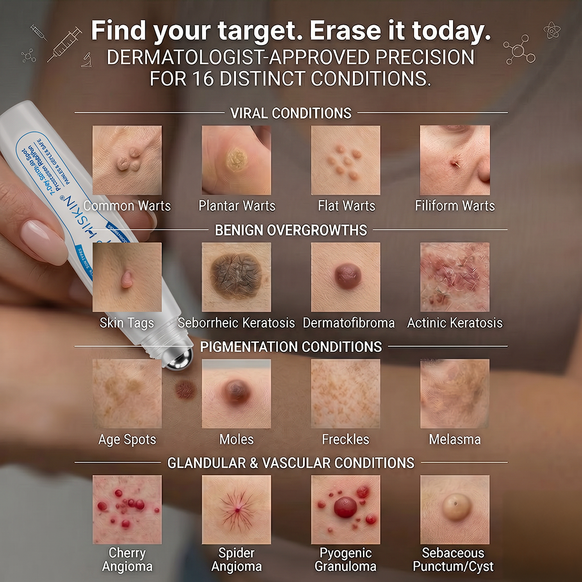 𝖧𝖨𝖲𝖪𝖨𝖭®👩‍⚕️⭐ 𝟕-𝐃𝒂𝘆 𝐒𝗸𝐢𝐧 𝐓𝒂𝗴 & 𝐒𝐩𝙤𝐭 𝐄𝐫𝒂𝐬𝙚𝐫 Painless & Scar-Free Advanced Imperfection Removal Rollerball Pen💎